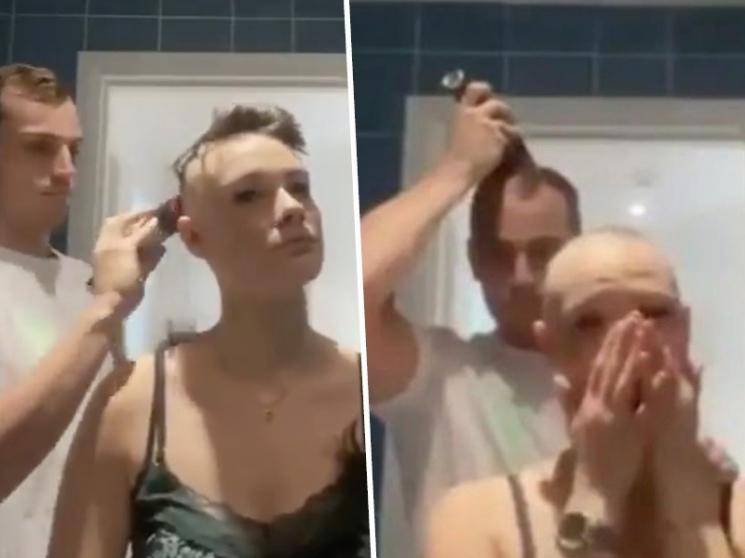 Man shaves girlfriend's head because of alopecia, then shaves his own