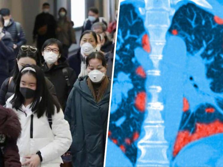 Wuhan's 90 percent recovered coronavirus patients now suffering from lung damage, report says - Daily news