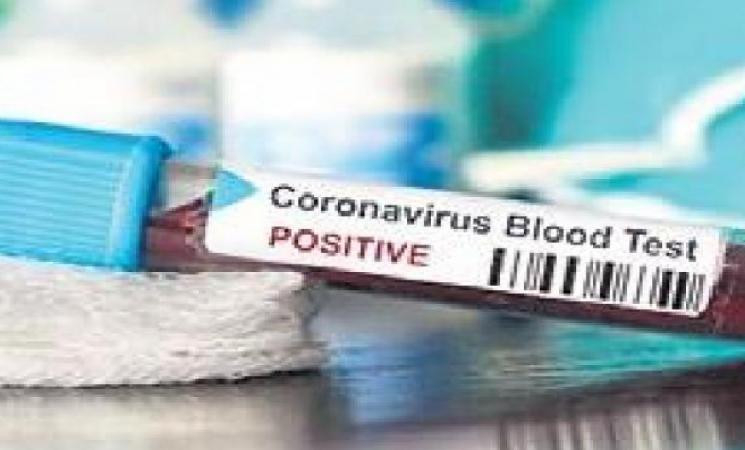 Nurse tests COVID-19 positive 1 week after getting vaccine shot! - Daily Cinema news