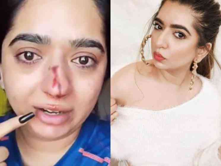 Hitesha chandranee attacked by zomato delivery boy ...